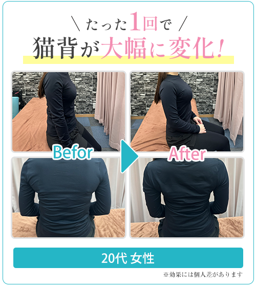 猫背ビフォーアフター